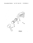 FACET JOINT IMPLANTS AND DELIVERY TOOLS diagram and image