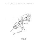 FACET JOINT IMPLANTS AND DELIVERY TOOLS diagram and image