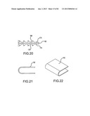 FACET JOINT IMPLANTS AND DELIVERY TOOLS diagram and image