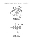 FACET JOINT IMPLANTS AND DELIVERY TOOLS diagram and image