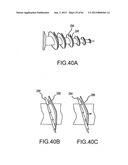 FACET JOINT IMPLANTS AND DELIVERY TOOLS diagram and image