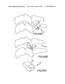 FACET JOINT IMPLANTS AND DELIVERY TOOLS diagram and image