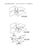 FACET JOINT IMPLANTS AND DELIVERY TOOLS diagram and image