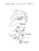 FACET JOINT IMPLANTS AND DELIVERY TOOLS diagram and image