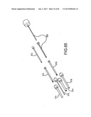 FACET JOINT IMPLANTS AND DELIVERY TOOLS diagram and image