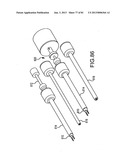 FACET JOINT IMPLANTS AND DELIVERY TOOLS diagram and image