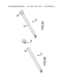 FACET JOINT IMPLANTS AND DELIVERY TOOLS diagram and image