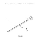 FACET JOINT IMPLANTS AND DELIVERY TOOLS diagram and image