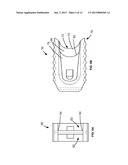 Methods and Systems for Interbody Implant and Bone Graft Delivery diagram and image