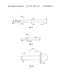 Methods and Systems for Interbody Implant and Bone Graft Delivery diagram and image