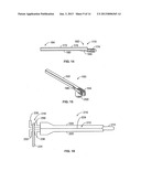 Methods and Systems for Interbody Implant and Bone Graft Delivery diagram and image