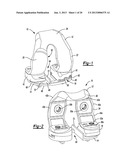 KNEE PROSTHESIS diagram and image