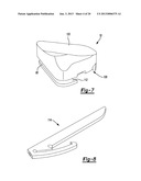 KNEE PROSTHESIS diagram and image