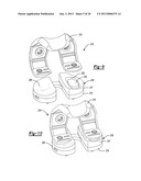 KNEE PROSTHESIS diagram and image