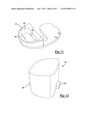 KNEE PROSTHESIS diagram and image