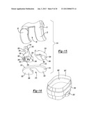 KNEE PROSTHESIS diagram and image