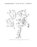 KNEE PROSTHESIS diagram and image