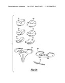 KNEE PROSTHESIS diagram and image