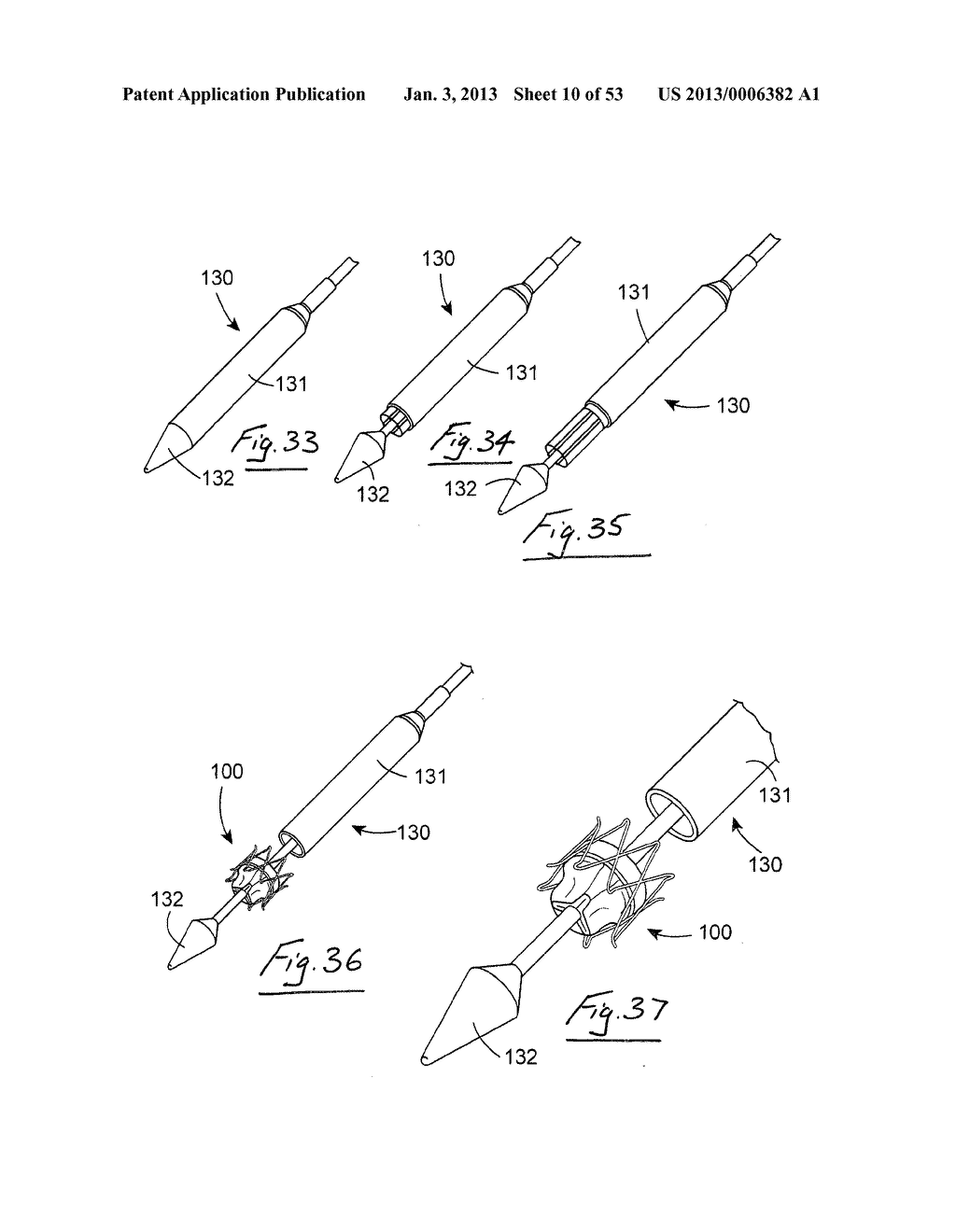 GASTROINTESTINAL IMPLANT DEVICE - diagram, schematic, and image 11