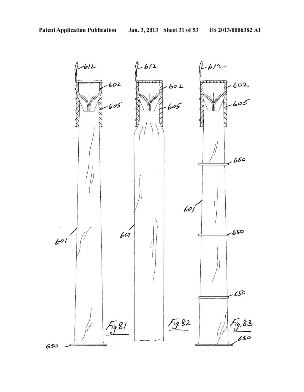 GASTROINTESTINAL IMPLANT DEVICE - diagram, schematic, and image 32