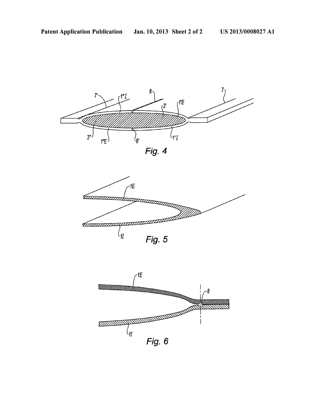 METHOD FOR PRODUCING A METAL INSERT TO PROTECT A LEADING EDGE MADE OF A     COMPOSITE MATERIAL - diagram, schematic, and image 03