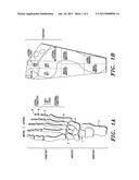 Shoe Insole diagram and image