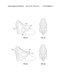 HEEL PROTECTOR diagram and image