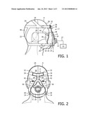 PATIENT INTERFACE DEVICE EMPLOYING A FLOATING ADJUSTABLE ARM diagram and image