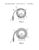 WELLBORE LASER OPERATIONS diagram and image