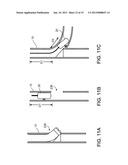 WELLBORE LASER OPERATIONS diagram and image