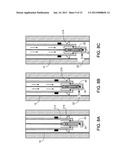 WELLBORE LASER OPERATIONS diagram and image