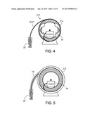 WELLBORE LASER OPERATIONS diagram and image