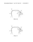 METHODS AND APPARATUS FOR TRANSMITTING VIBRATIONS diagram and image