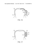 METHODS AND APPARATUS FOR TRANSMITTING VIBRATIONS diagram and image