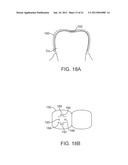 METHODS AND APPARATUS FOR TRANSMITTING VIBRATIONS diagram and image