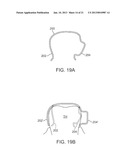 METHODS AND APPARATUS FOR TRANSMITTING VIBRATIONS diagram and image