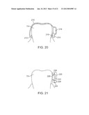 METHODS AND APPARATUS FOR TRANSMITTING VIBRATIONS diagram and image