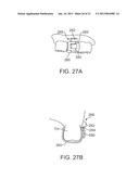 METHODS AND APPARATUS FOR TRANSMITTING VIBRATIONS diagram and image