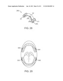 METHODS AND APPARATUS FOR TRANSMITTING VIBRATIONS diagram and image