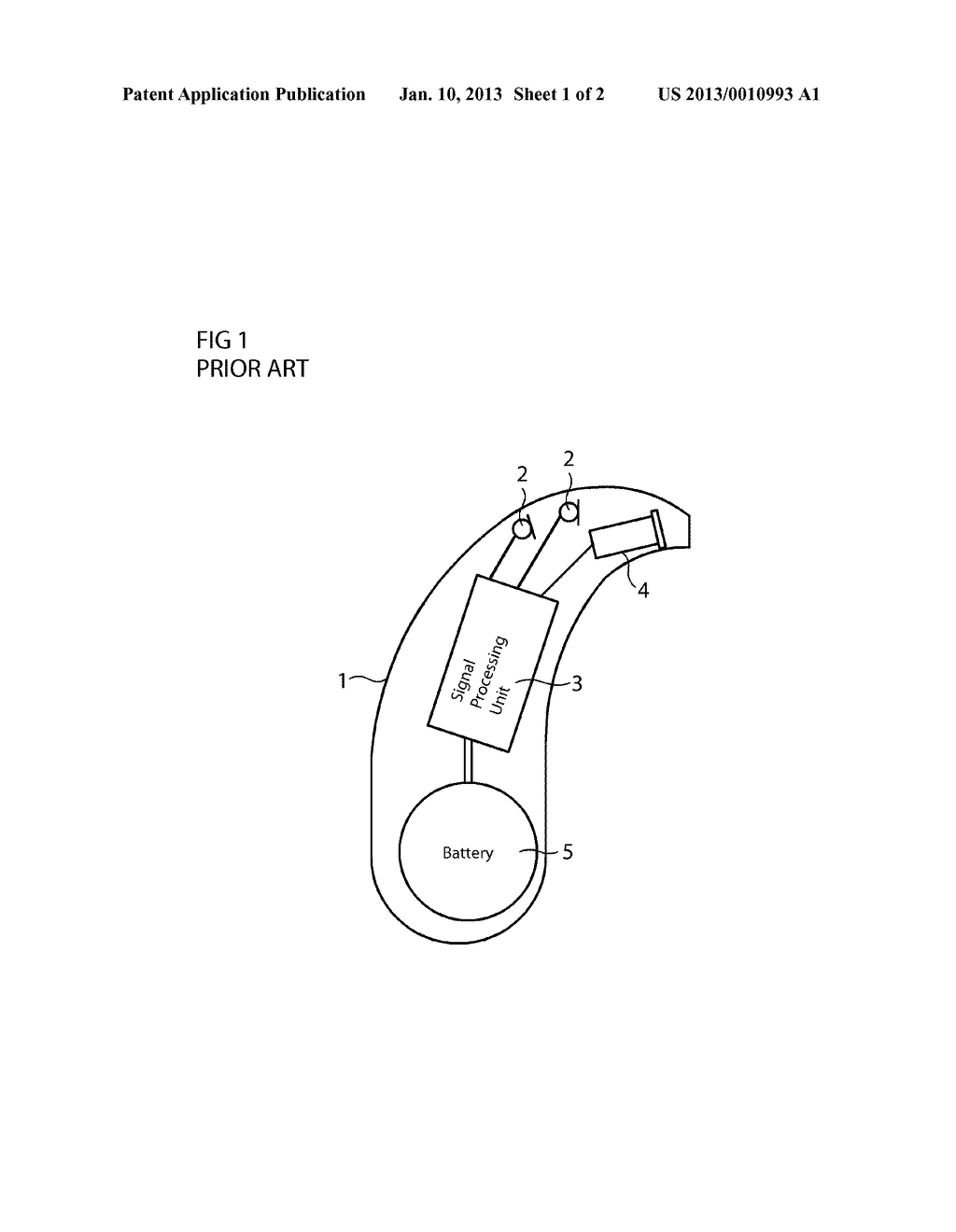 MOLDING STRUCTURE FOR A HEARING APPARATUS, HEARING APPARATUS AND METHOD OF     PRODUCING THE MOLDING APPARATUS - diagram, schematic, and image 02