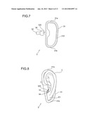 AURICLE-INSTALLED APPARATUS diagram and image