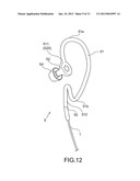 AURICLE-INSTALLED APPARATUS diagram and image