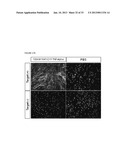 MODIFIED UBIQUITIN PROTEINS HAVING A SPECIFIC BINDING ACTIVITY FOR THE     EXTRADOMAIN B OF FIBRONECTIN diagram and image