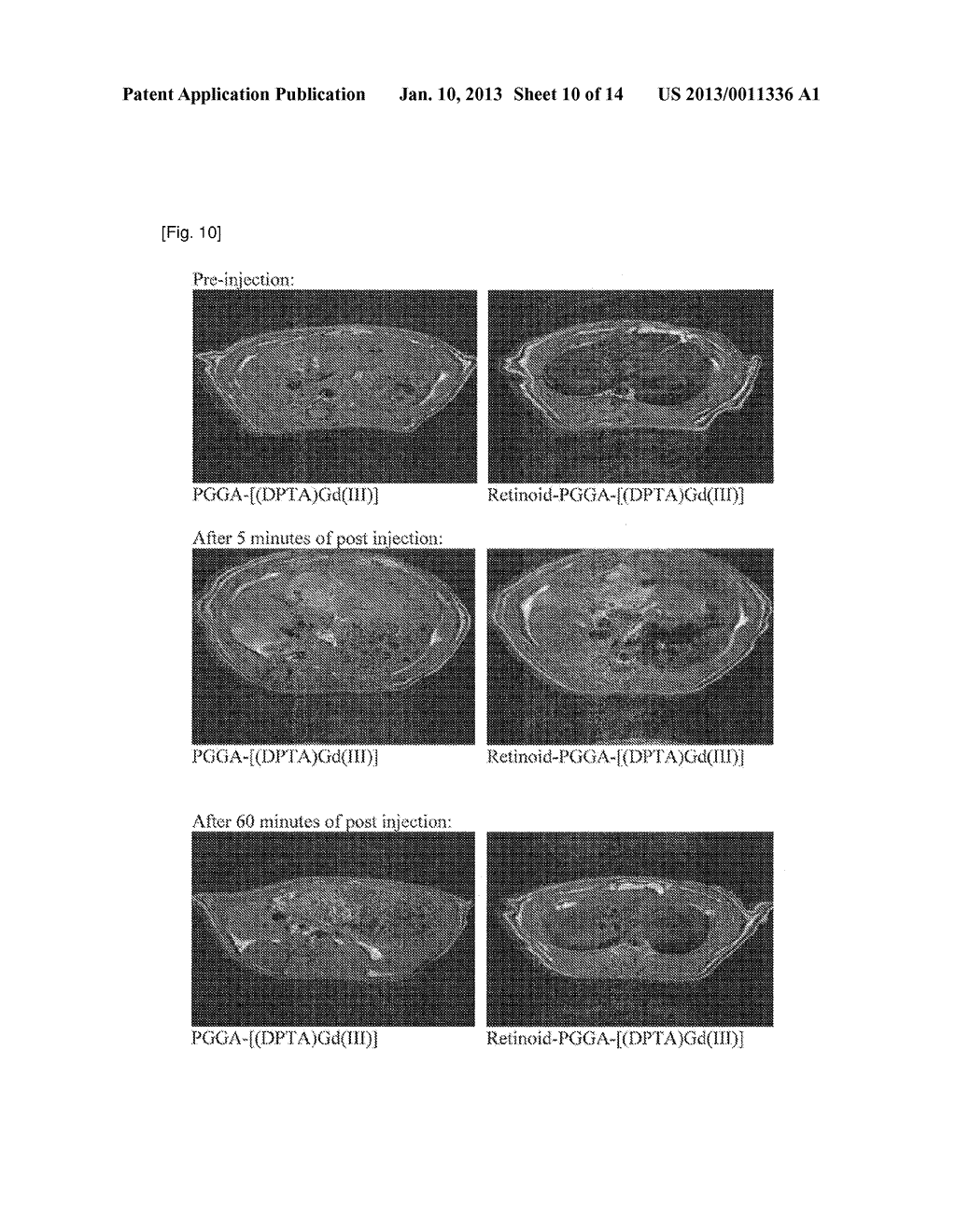 IMAGING AGENTS OF FIBROTIC DISEASES - diagram, schematic, and image 11