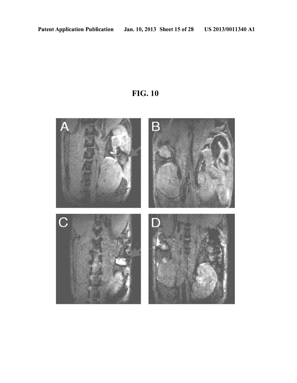 COMPOSITIONS AND METHODS COMPRISING MAGNETIC RESONANCE CONTRAST AGENTS - diagram, schematic, and image 16