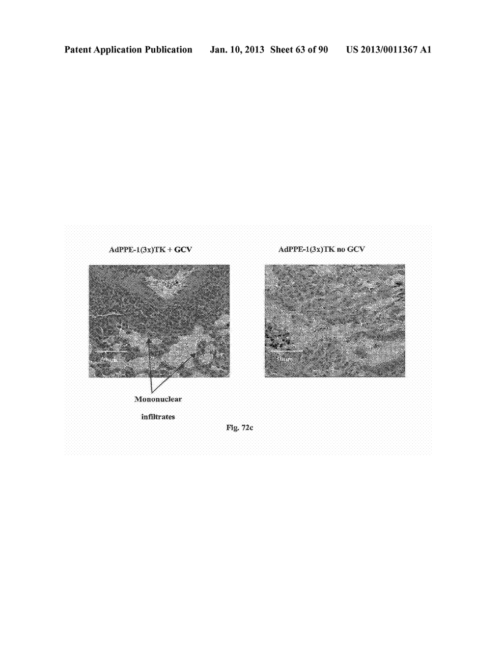 Promoters Exhibiting Endothelial Cell Specificity and Methods of Using     Same for Regulation of Angiogenesis - diagram, schematic, and image 64