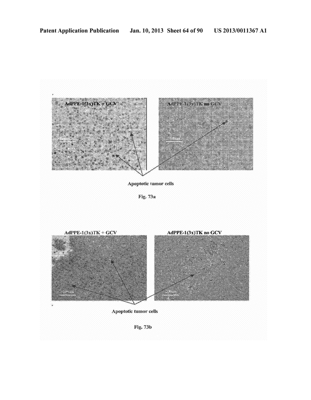 Promoters Exhibiting Endothelial Cell Specificity and Methods of Using     Same for Regulation of Angiogenesis - diagram, schematic, and image 65