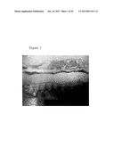 Method and Pharmaceutical Composition for Treatment of Intestinal Disease diagram and image