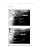 Method and Pharmaceutical Composition for Treatment of Intestinal Disease diagram and image