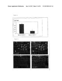 Method and Pharmaceutical Composition for Treatment of Intestinal Disease diagram and image